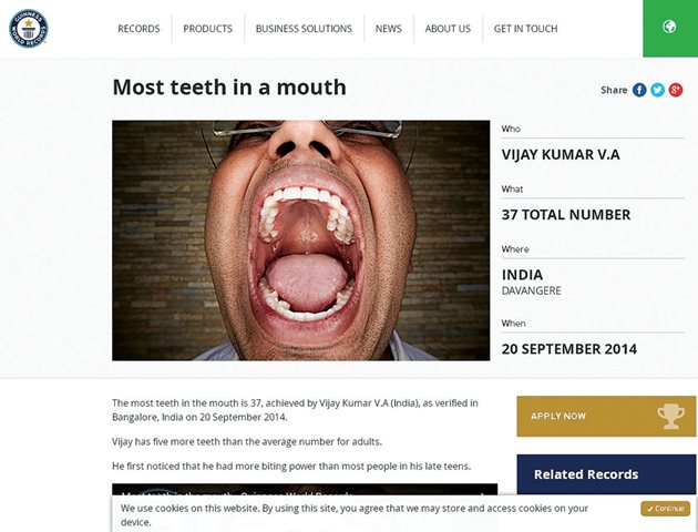 Снимка на устата с рекордния брой зъби на сайта на Рекордите на "Гинес"