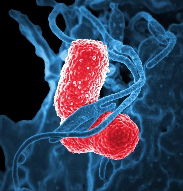 Бактерията, причиняваща пневмония Снимка: Пиксабей
