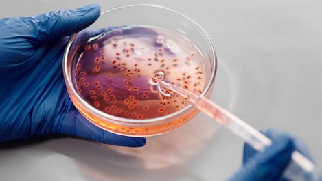 Девет от най-вредните бактерии за хората