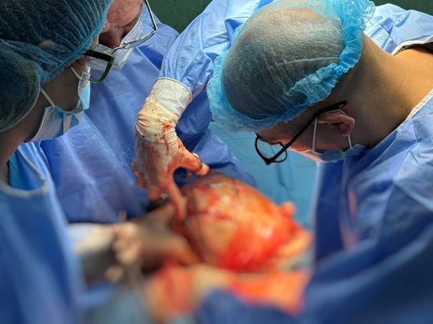 Лекарите по време на операцията.

Снимка: фейсбук