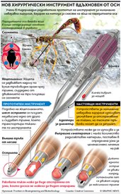 Оси дават старт на нова ера в операциите (Инфографика)