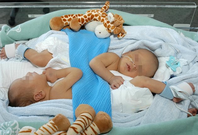 29 юни 2007 г.: току-що родени сиамски близнаци с незначителна свързаност на тъкани в областта на гърдите в Детската болница в Цюрих. Седмица по-късно болницата съобщава, че децата са успешно разделени.